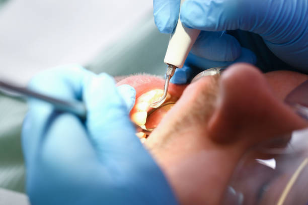 Best Emergency Dentist for Lost Fillings or Crowns in Glasgow, OR