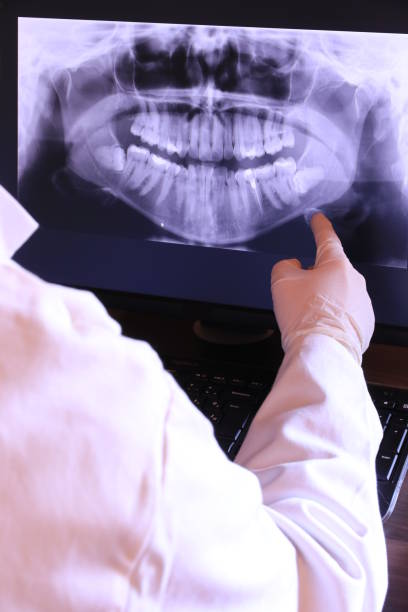 Best Emergency Dental Extractions in Glasgow, OR
